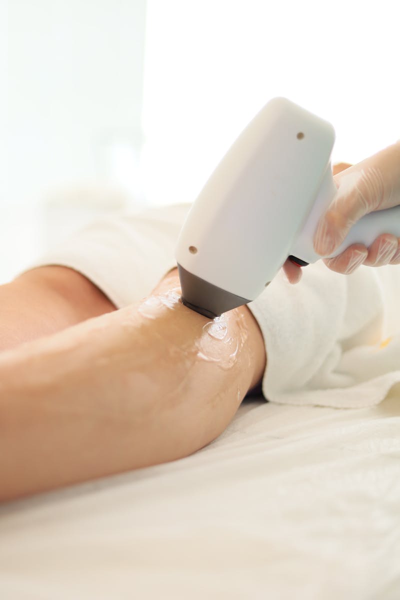 Laser – Φωτοανάπλαση IPL - pexels laser ipl